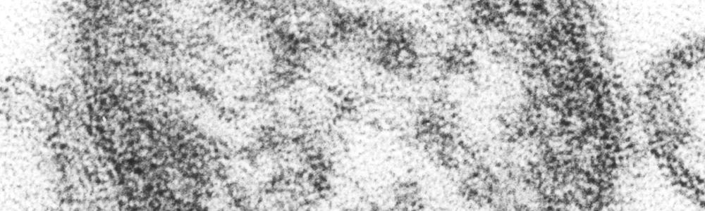 Ein Masernvirus als mikroskopisches Bild