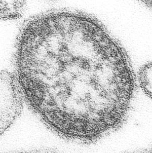 Ein Masernvirus als mikroskopisches Bild
