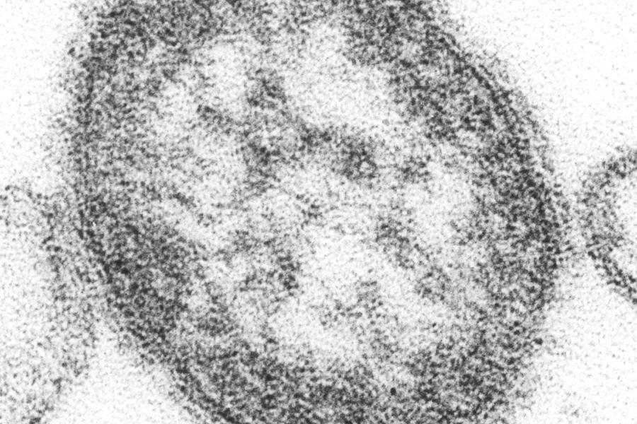 Ein Masernvirus als mikroskopisches Bild
